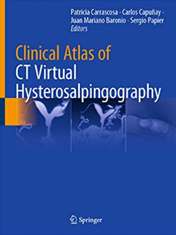 Tapa Clinical Atlas of CT Virtual Hysterosalpingography