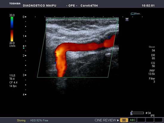 Para que sirve la ecografia doppler obstetrica