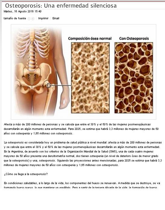 osteoporosis genteba