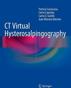 Tapa Hysterosalpingography