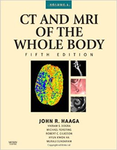 TAPA CT AND MRI