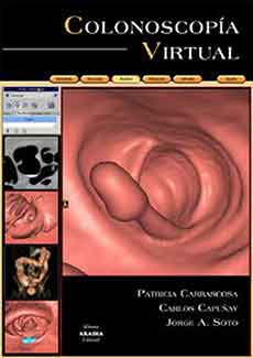 Tapa Libro Colon